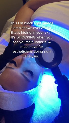UV Black Light Woods Lamp for Skin Analysis