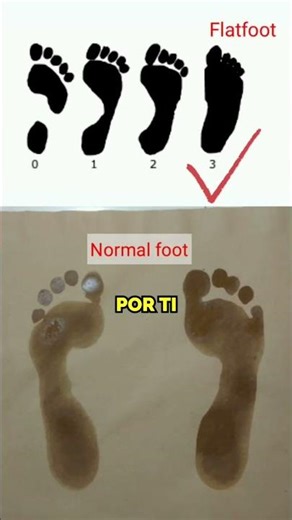 Why Army Recruits Step in Red Ink