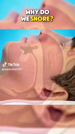 Why Do We Snore 3D Animation #snore #snoring #sleepapnea #sleepapneacause #snorecause #snoringcauses #snoretreartment #snoringtreatment #medical3danimation #3dmedicalanimation