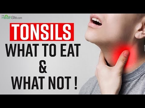 Tonsils Remedies: What To Eat And What To Avoid In Tonsils | Sore Throat Treatment