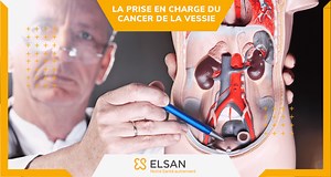 Le cancer de la vessie: Diagnostic, Traitements et Radiothérapie