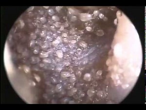 Ear Mites in Cats and Dogs