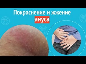 😧 Redness and burning of the anus. Case report #1114