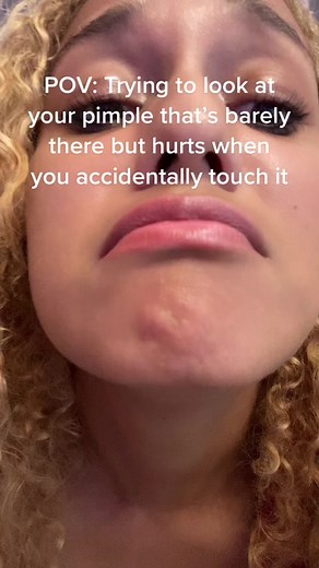 Dealing with Painful Pimples: Tips and Remedies