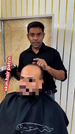 Skin Hair patch price. #hairpatchprice #hair #parvezhair #viral #wigmaker | Parvez Hair