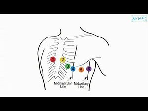 midaxillary line (English) - Medical terminology for medical students -