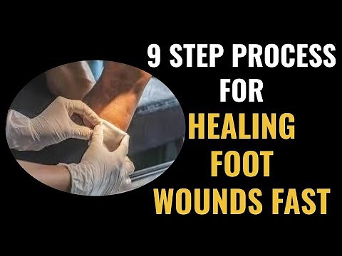 Heal My Foot Wound Fast