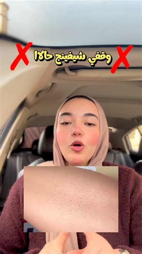 ‎﮼دكتورة﮼ثوعاد | Cosmetologist 👩‍🔬‎ on Instagram‎: "⁨ الشيفينج ممكن يكون سبب اساسي في جلد الوزة و الترطيب هو الحل الوحيد 💗 🔺 هنستخدم كريم اليوريا علي بشرة مندية و بعده هتحطي طبقة من لوشن الجسم كل يوم ✨⁩"‎