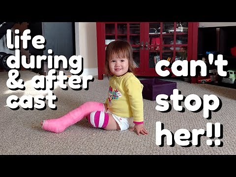 Toddler Broken Leg, Cast, & Recovery (cute 7 week summary)