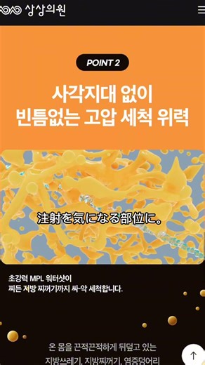 脂肪溶解注射
