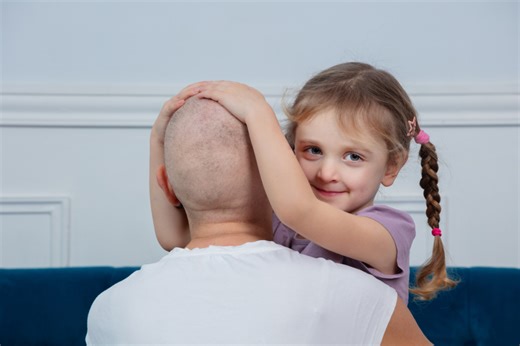 Perte de cheveux : les effets secondaires graves d’un médicament pris par des milliers d’hommes