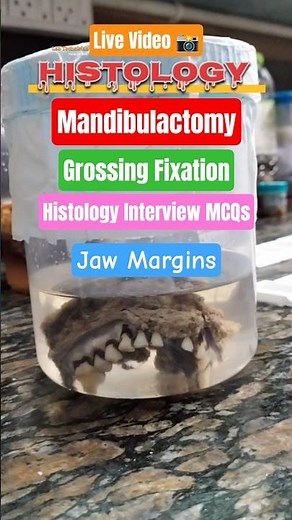 Histopathology biopsy fixation||histology grossing||Biopsy Grossing Fixation #lab #shortvideo