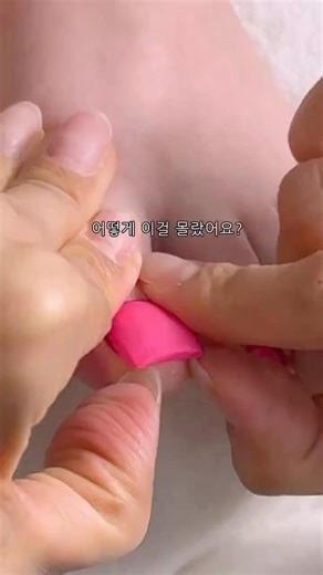 발톱펴기 #아크릴연장 #파고드는발톱