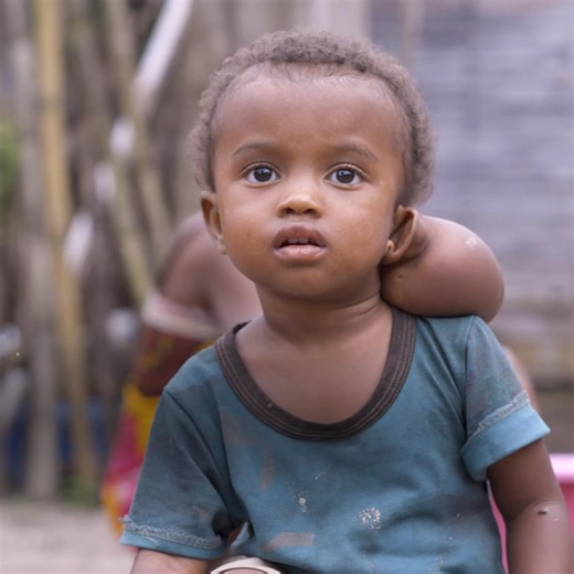 No child should endure what little Armella experienced. A tumor began to develop behind her ear. Local doctors couldn't help. She needed surgery, which was made possible by caring friends like you. Your gift today will help another child receive safe, free surgery. It's love like this that transforms lives. Today, your gift goes 2x further. | Mercy Ships