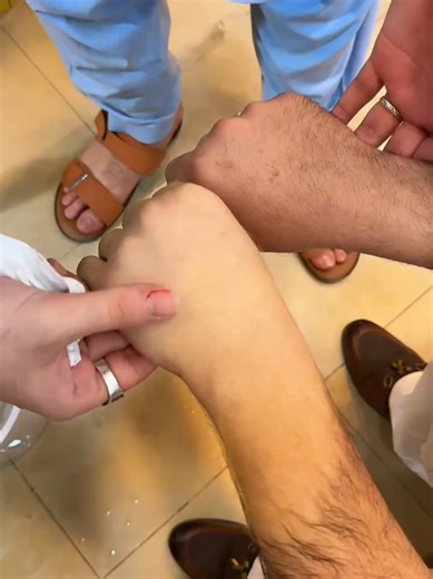 MTC Skin Polish: Clear Results for Happy Customers