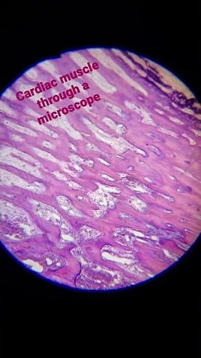 Cardiac muscle through a microscope