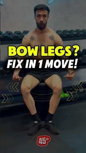 Fix Bow Legs at Home in 1 Move | Easy Knee Correction Exercise