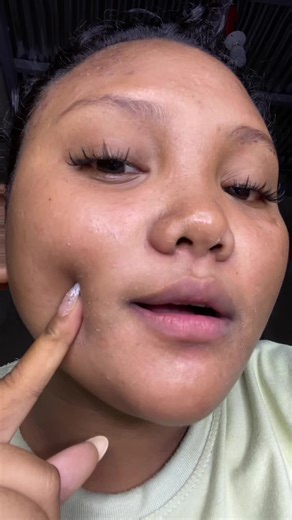 Rejuv Set Skincare: Your Guide to Radiant Skin