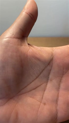 Interpretación de la X en Lectura de Manos