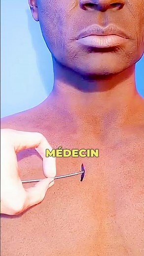 Comment fonctionne un stimulateur cardiaque 😮