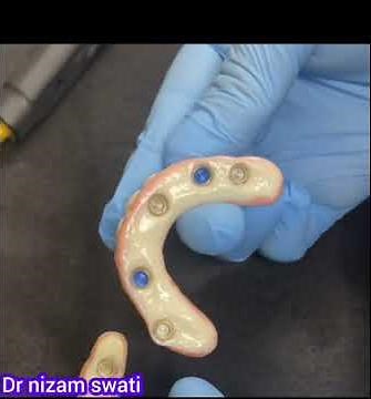 how to fit dental full denture in patient mouth