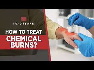 Chemical Burn Treatment: Critical First Aid You Need To Know