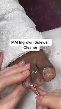 7 Essential Pedicure Tools to Improve Toenail Health at Home