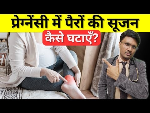 TIPS TO MANAGE PEDAL EDEMA IN PREGNANCY