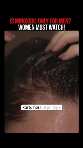 Is Minoxidil Only for Men? 🤔 #HairLoss #Minoxidil #Health