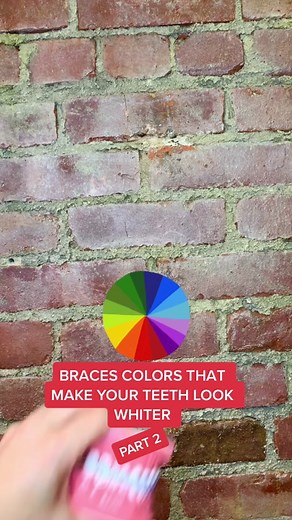 Fun Braces Colors to Make Your Teeth Look Whiter
