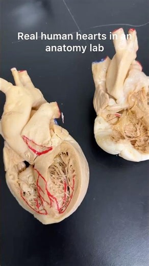Two real human hearts - can you spot the difference?