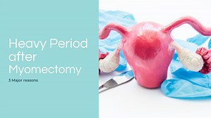 Heavy Period After Myomectomy: 3 Extraordinary Reasons