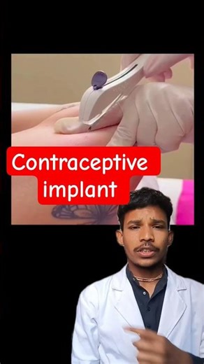 contraceptive implant
