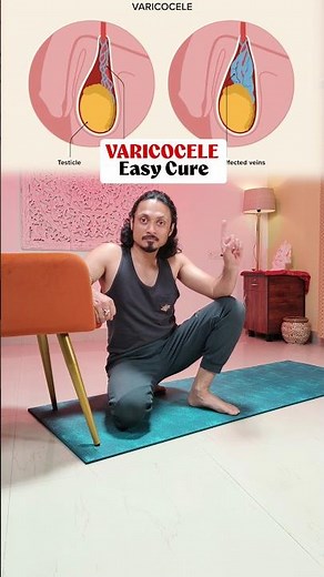 5 Easy Exercises to cure Varicocele at Home