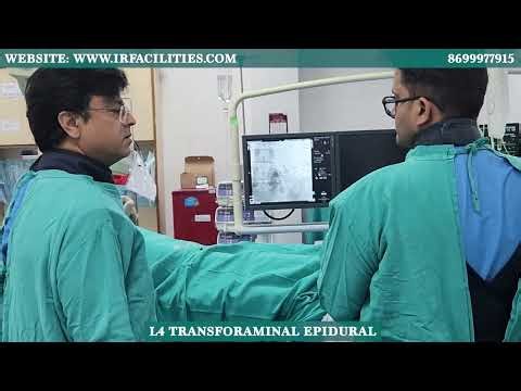 L4 Transforaminal Epidural by Dr. Sandeep Sharma | IRFACILITIES