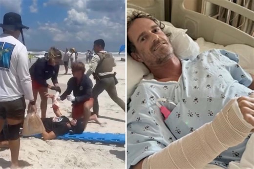 Florida surfer attacked in ‘Shark Bite Capital of the World’