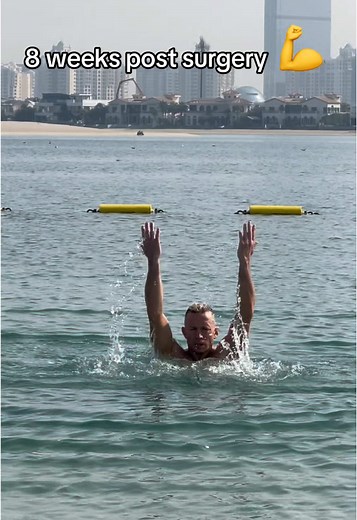 8 Weeks Post-Surgery: My Rehabilitation Journey