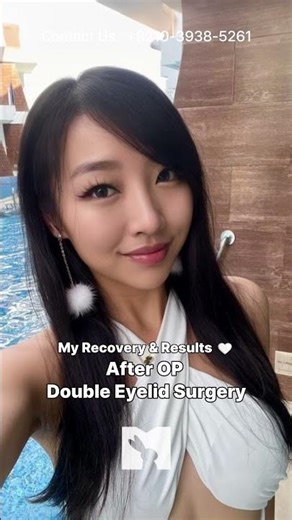 LALAMEDI | Considering eyelid surgery in Korea? 👀✨ #shorts