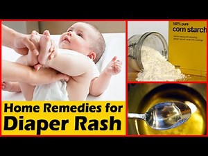 Top 5 Home Remedies to Soothe Diaper Rash in Babies