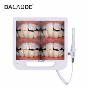 [Hot Item] HD Dental Monitor with Versatile Intraoral Camera