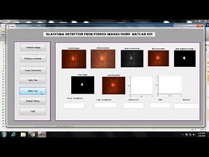 Glaucoma Detection from Fundus Images Using MATLAB GUI | Matlab Image Processing Final Year Project