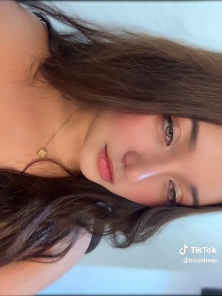 Transformative Rhinoplasty Journey: Before and After