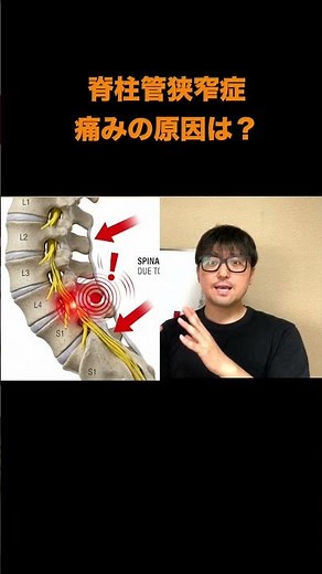脊柱管狭窄症の人がふくらはぎを揉んではいけない理由#脊柱管狭窄症#腰痛 #整体