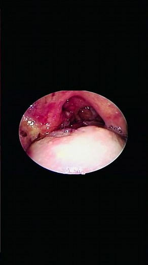 Inside the Throat 👀🔥 | Professional ENT Throat Check-Up #Doctor #Medical #Viral