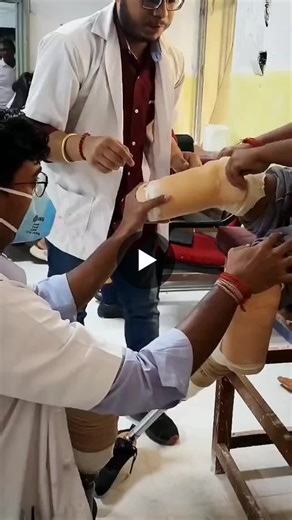 Transtibial Amputation Rehabilitation: Improved Gait and Mobility | Pralay Das posted on the topic | LinkedIn