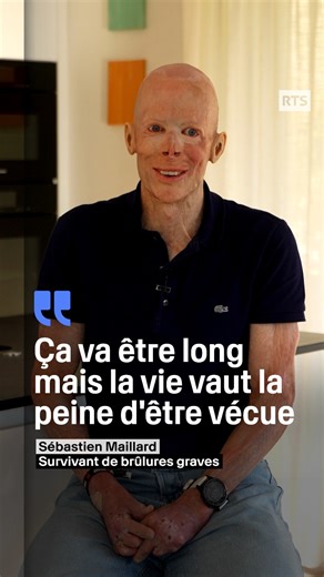 "Ça va être long mais la vie vaut la peine d'être vécue" Sébastien Maillard, 48 ans, est un exemple de résilience après un grave accident de travail en 2000, où il a été brûlé à 92 % de son corps. À seulement 23 ans, alors mécanicien poids lourds, il a survécu à une explosion de carburant qui l’a transformé en « torche vivante ». Grâce à l’intervention rapide de collègues, il a pu être sauvé. Malgré les défis, Sébastien a rapidement accepté ses blessures, soutenu par sa compagne Karine. Aujourd’