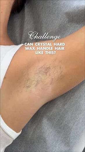 3.2K views · 18 reactions | Crystal Hard Wax This semi-transparent SP polymer wax removes even 1 mm hairs on sensitive areas like the bikini line, face, and underarms. Ultra-flexible, hypoallergenic, and designed for a smooth, comfortable waxing experience. ✨Order the Crystal Hard Wax at buyitalwax.com (link is in bio) | ItalWax USA | Facebook
