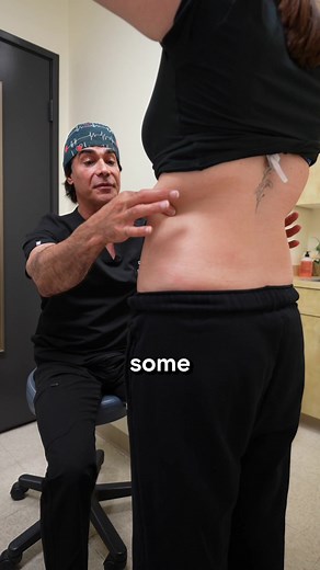 Effective Body Contouring Techniques for Snatched Curves