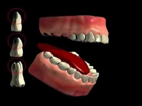 Tooth Furcation (Bifurcation, Trifurkation)