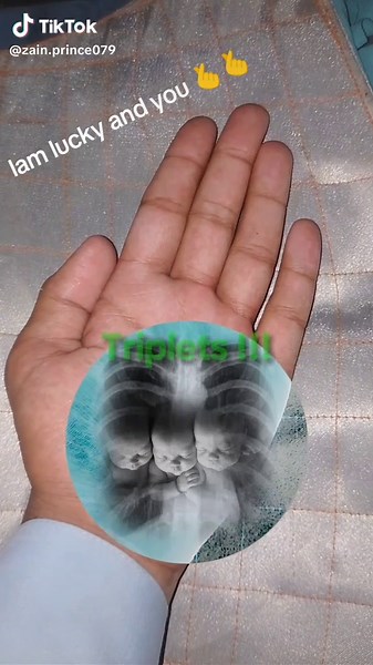 future x-ray filter you can use viral video on tik Tok #fypシ゚viral